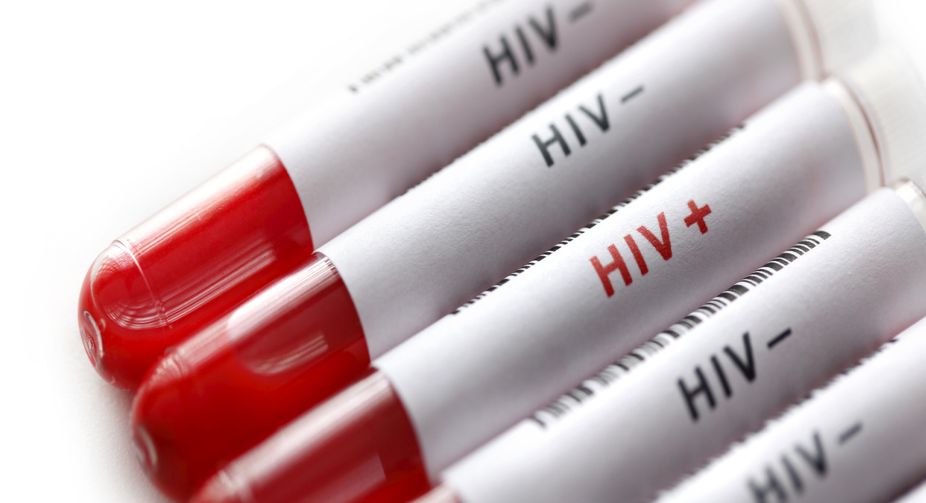 HIV vaccine efficacy study begins in South Africa