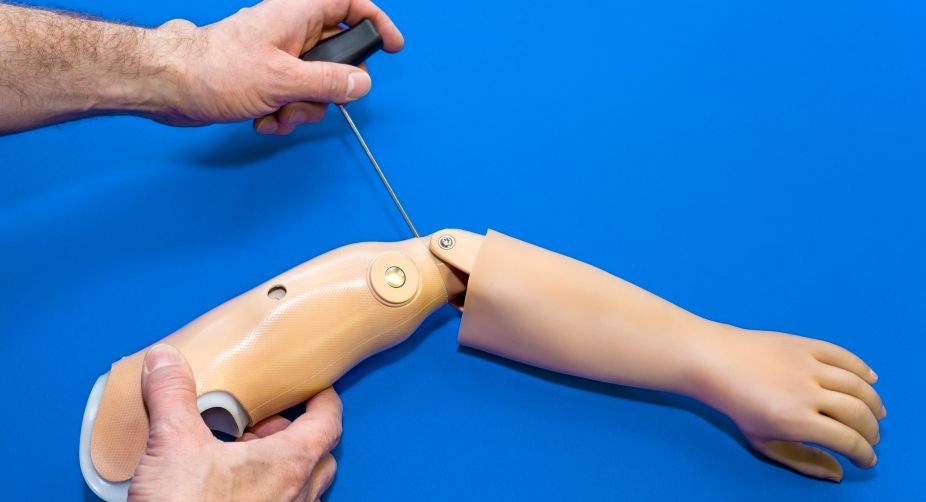 Now, affordable prosthetic hand