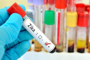 Zika virus may have adverse effects on heart