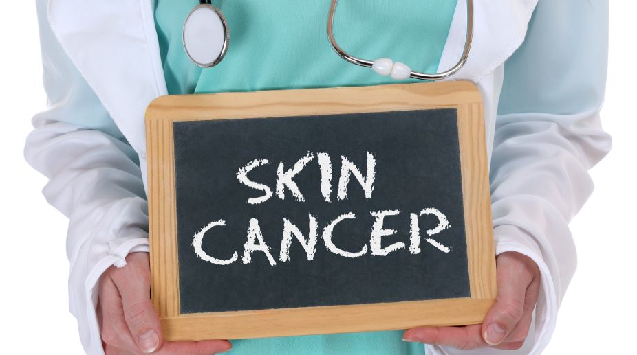 Artificial Intelligence system to help detect skin cancer
