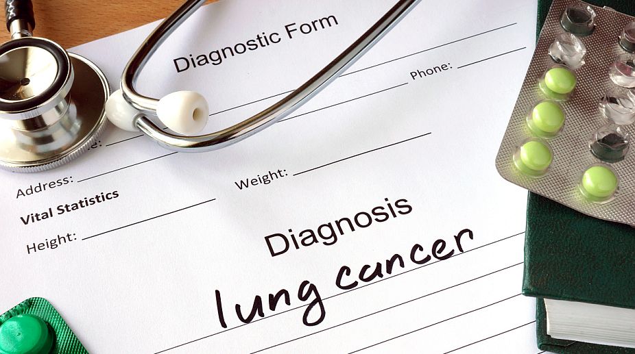 Statins may not help lung cancer patients
