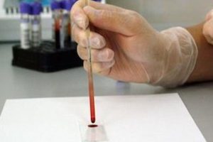 New blood test may detect cancer at early stage