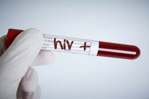 Our ancestors wiped out HIV-type virus 11 million years ago