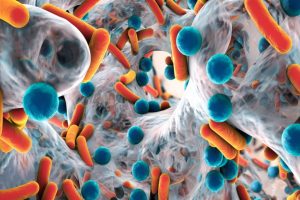 New, quick test to identify superbug infection