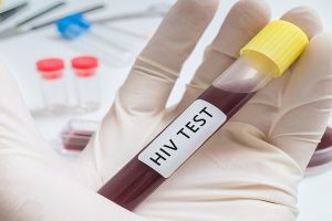 Experimental HIV vaccine is well-tolerated in adults