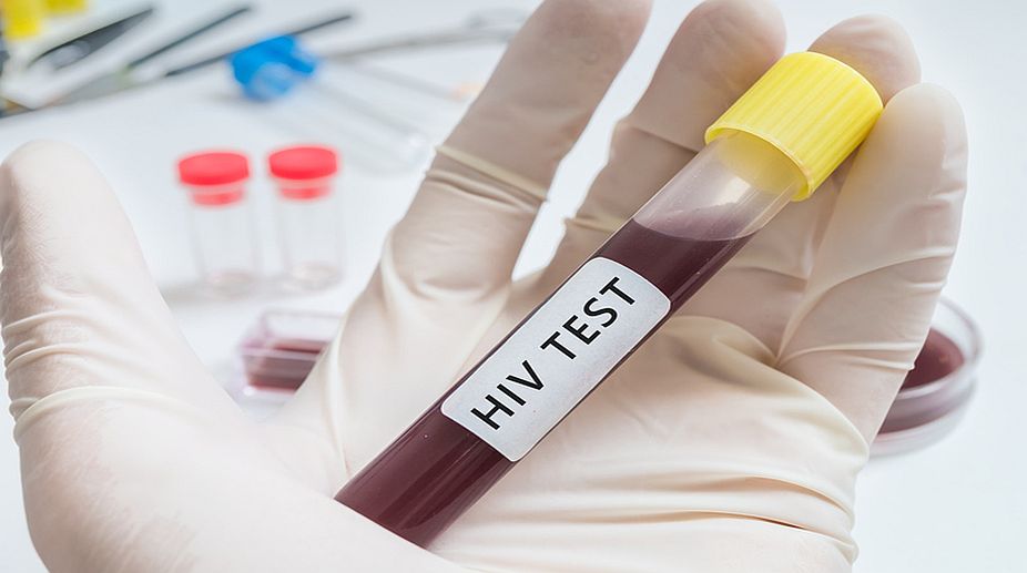 New low-cost test to detect hidden HIV faster