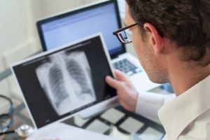 Even low dose X-rays could harm your heart