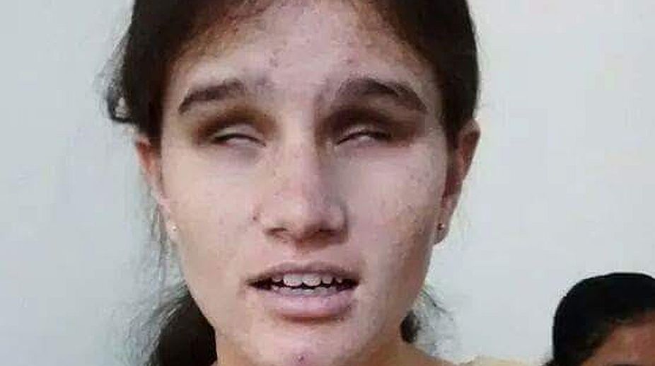 Visually-impaired girl is ‘Youth Icon’ for Himachal assembly polls