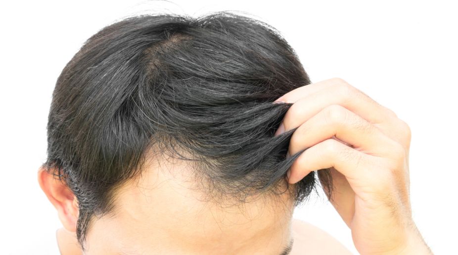 Fossilised hair five times rarer than feathers