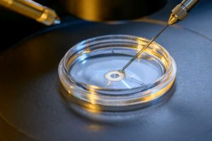 Now, IVF the preferred method for gender selection