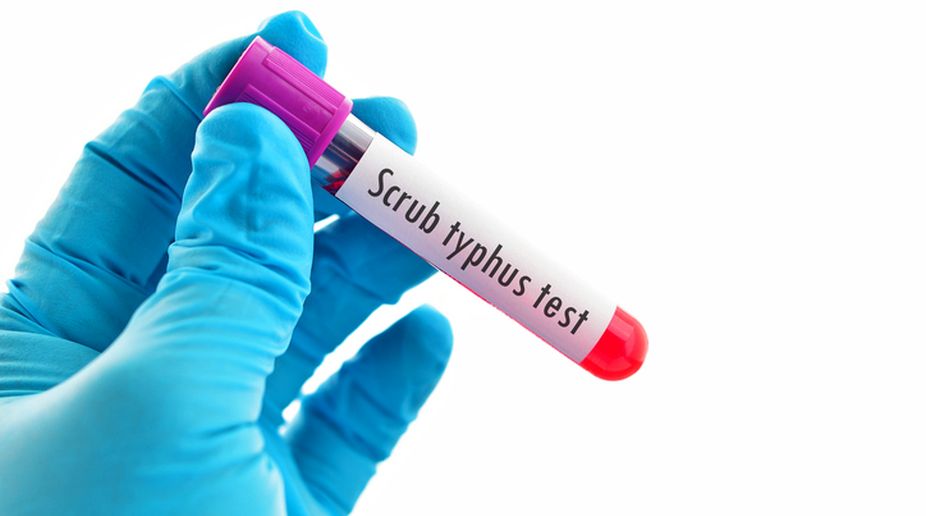 Scrub typhus continues to claim maximum lives in Himachal