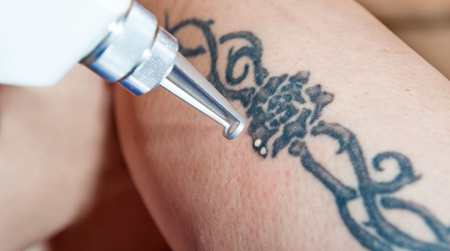 ‘Hygiene is a big concern in tattooing in India’