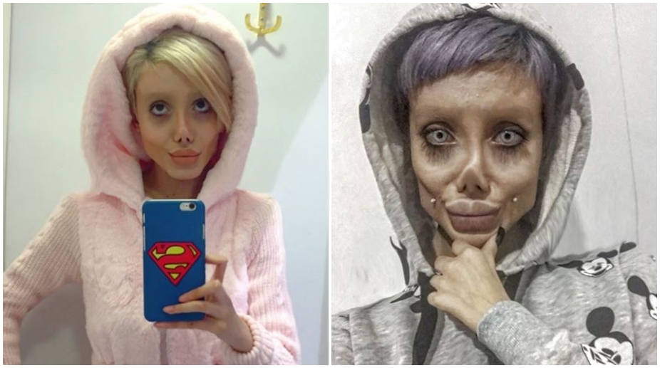 19-yr-old girl gets multiple surgeries done to look like Angelina Jolie; pics