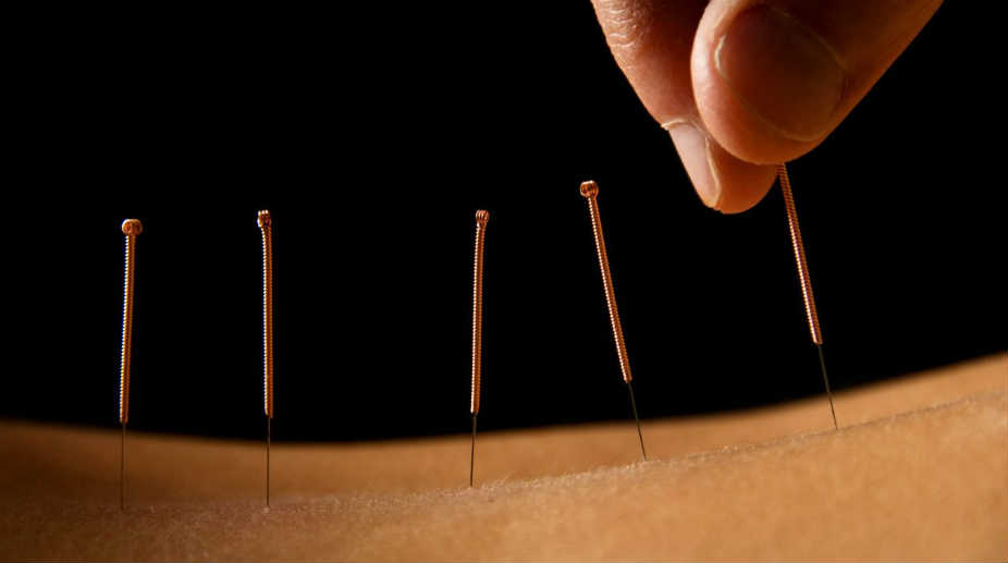 Acupuncture may boost chances of pregnancy through IVF