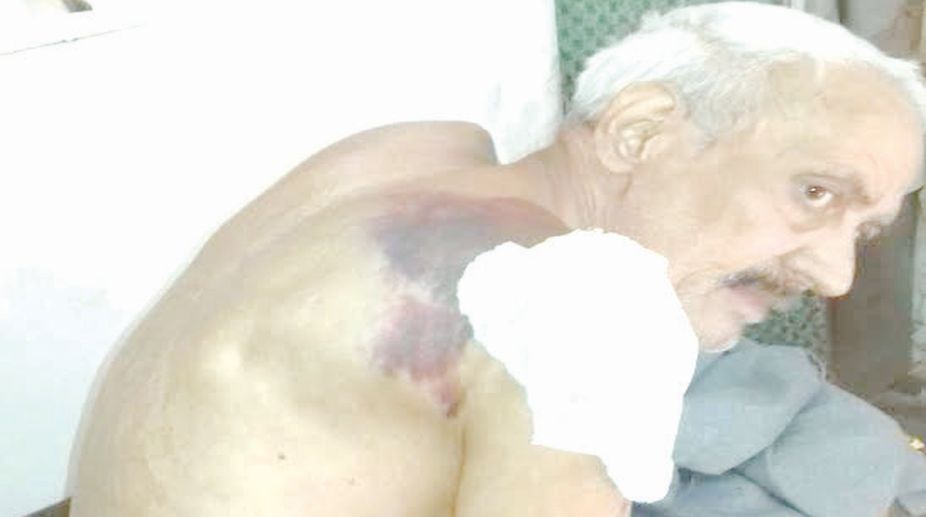 Senior citizen assaulted by Home Guards