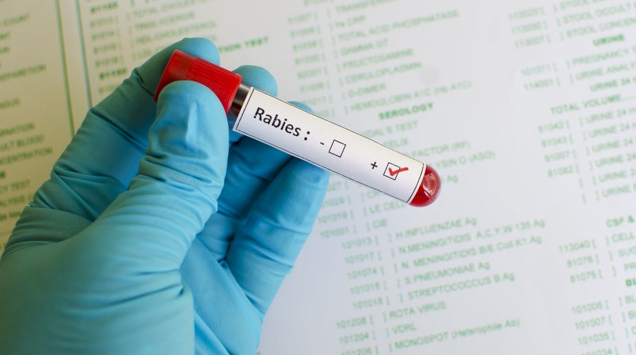 No evidence of rabies virus in raw milk of rabid cow: WHO report