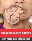 Tobacco product packs image