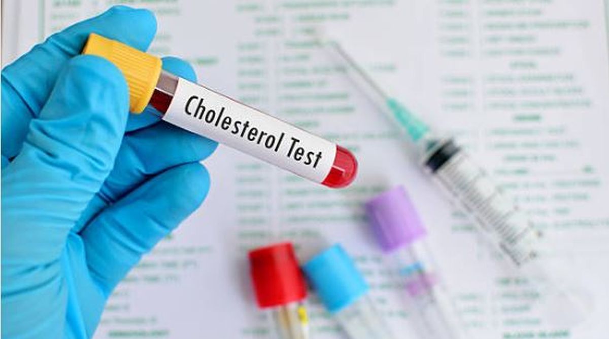 Cholesterol — for a new life?