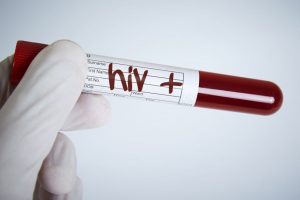 Nearly 40 individual HPV types linked to HIV infection