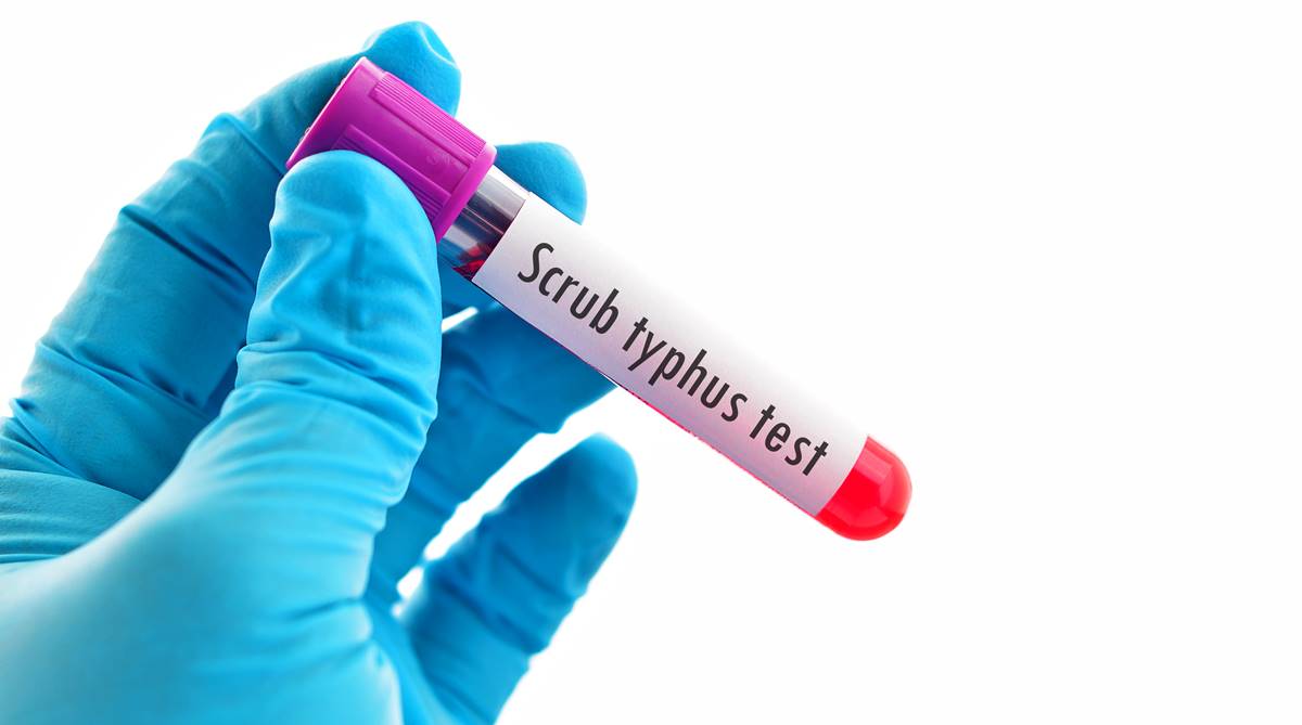 Bengal: Encephalitis patients need to undergo scrub typhus tests
