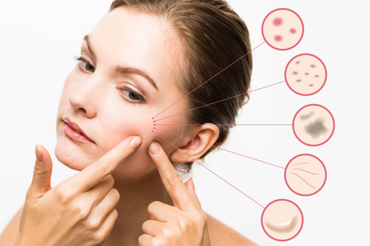 How to fight the tough winter pimples?