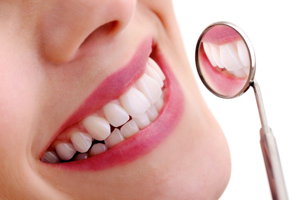Tips to remember post teeth whitening treatment