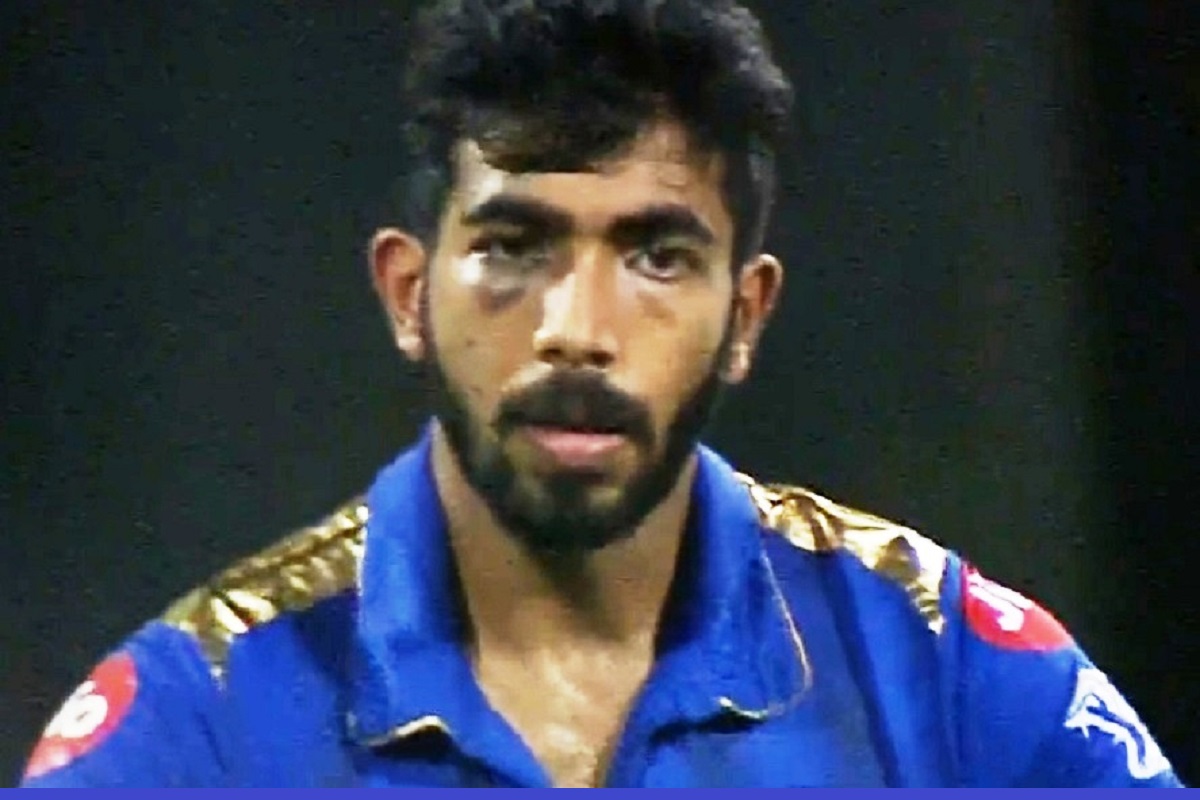 Jasprit Bumrah suffers another scare as ball hits eye