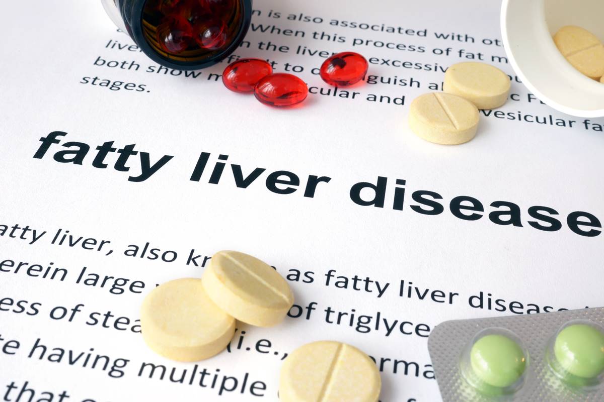 Even the skinny can get fatty liver