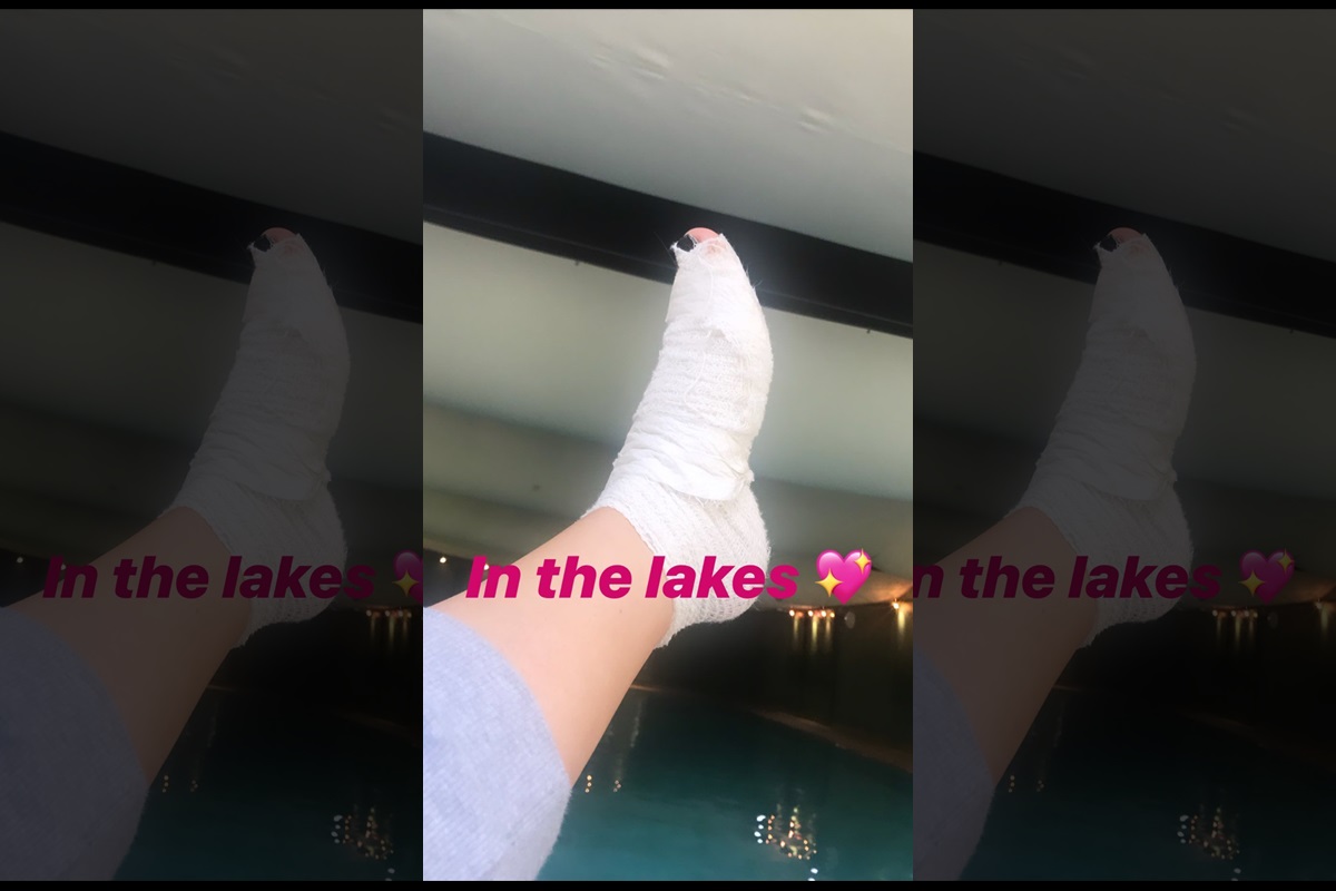 Helen Flanagan gets burnt with a shisha pipe, can’t walk for a while