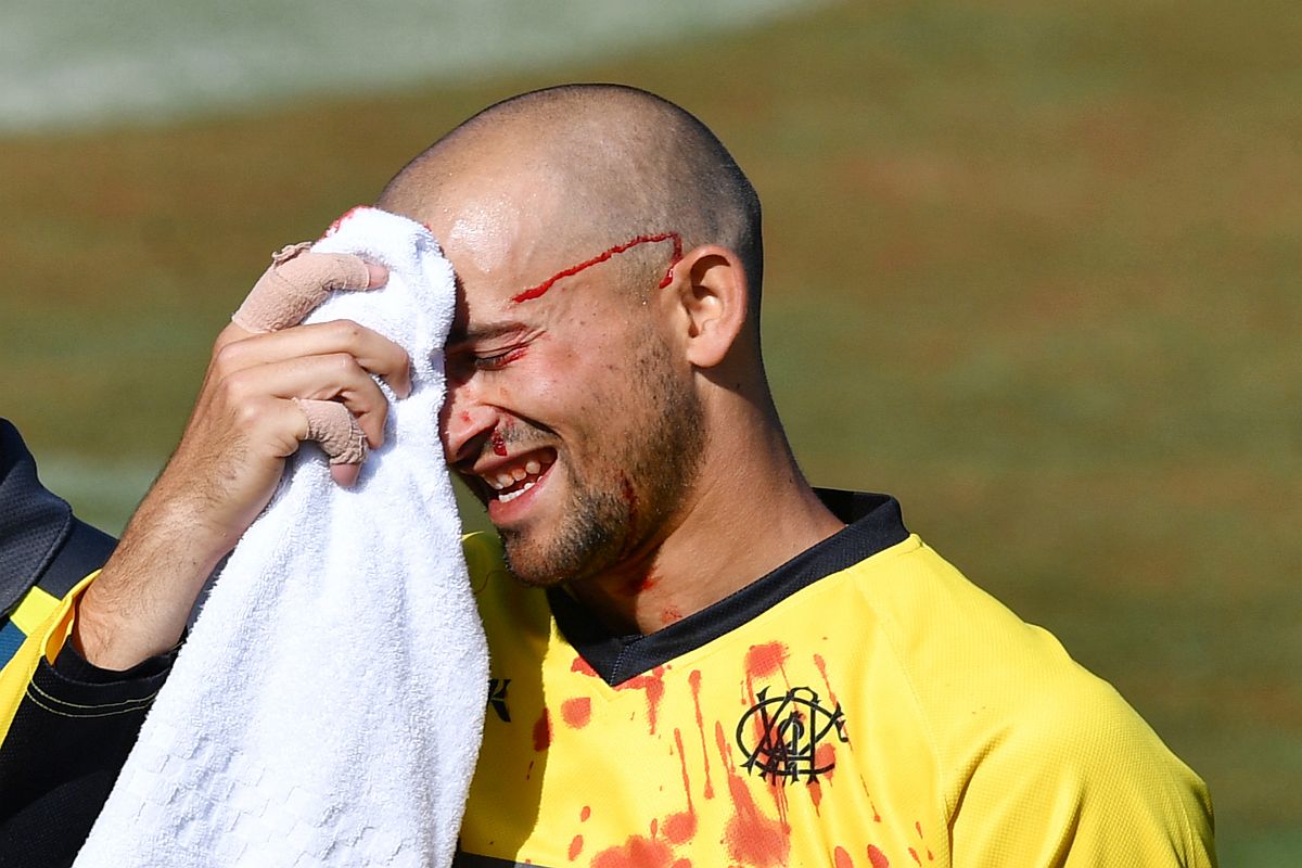 Australia cricketer Ashton Agar suffers blow on face after being hit by his own brother