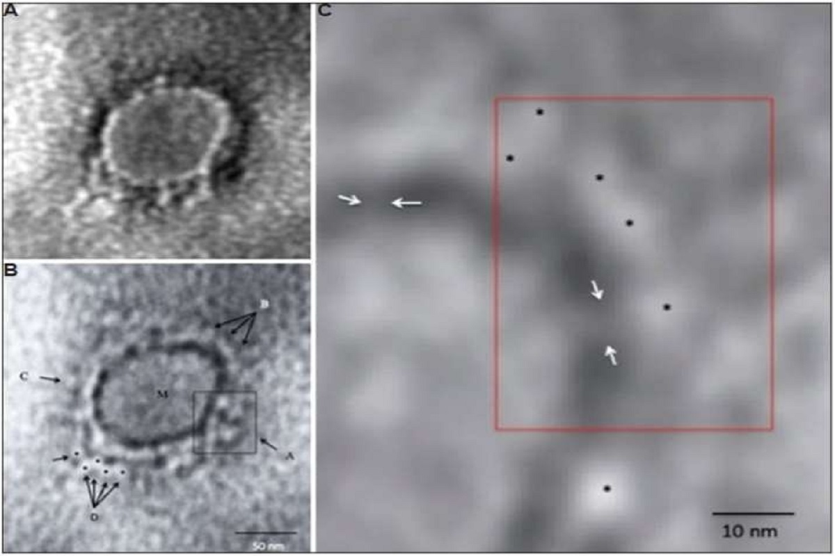 India releases first electron microscope images of COVID-19