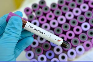 Two more test positive for coronavirus in state