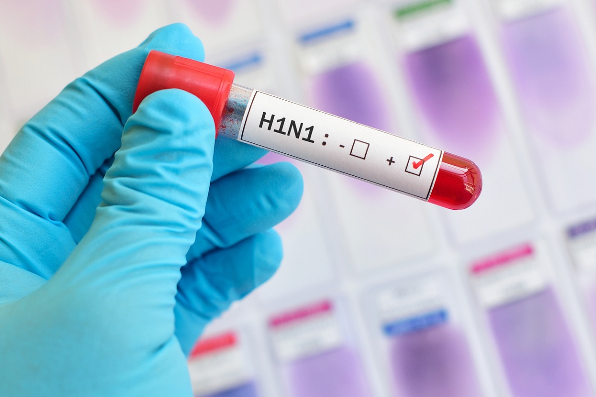 13 cases of swine flu in WB