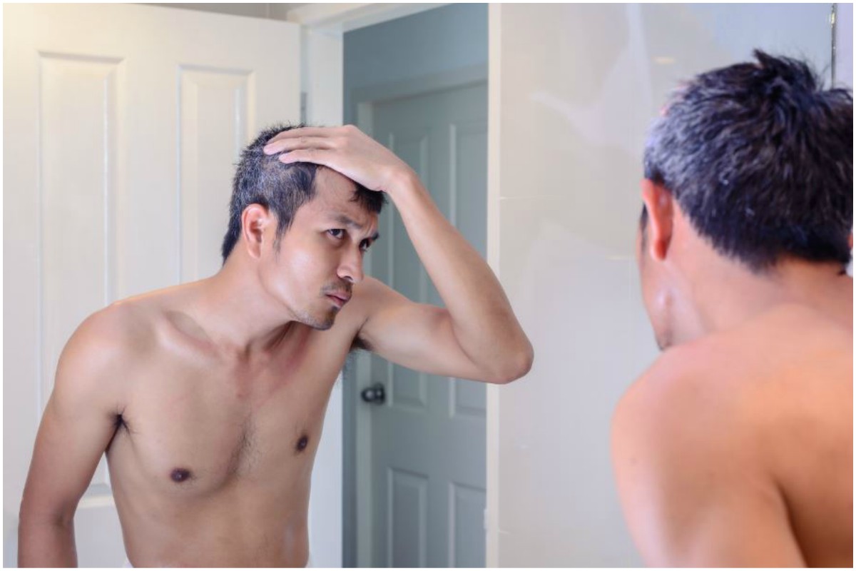 Complete Guide To PreMature Greying Of Hair