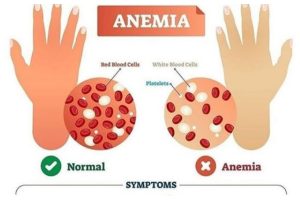 Treat anaemia timely to avoid serious complications