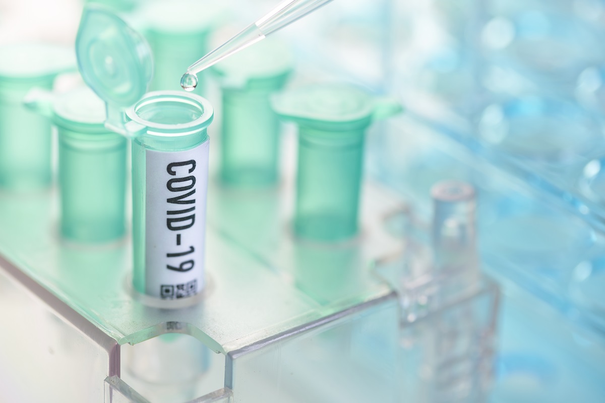 Abbott’s serology blood tests for COVID-19 to be available in India by end of May