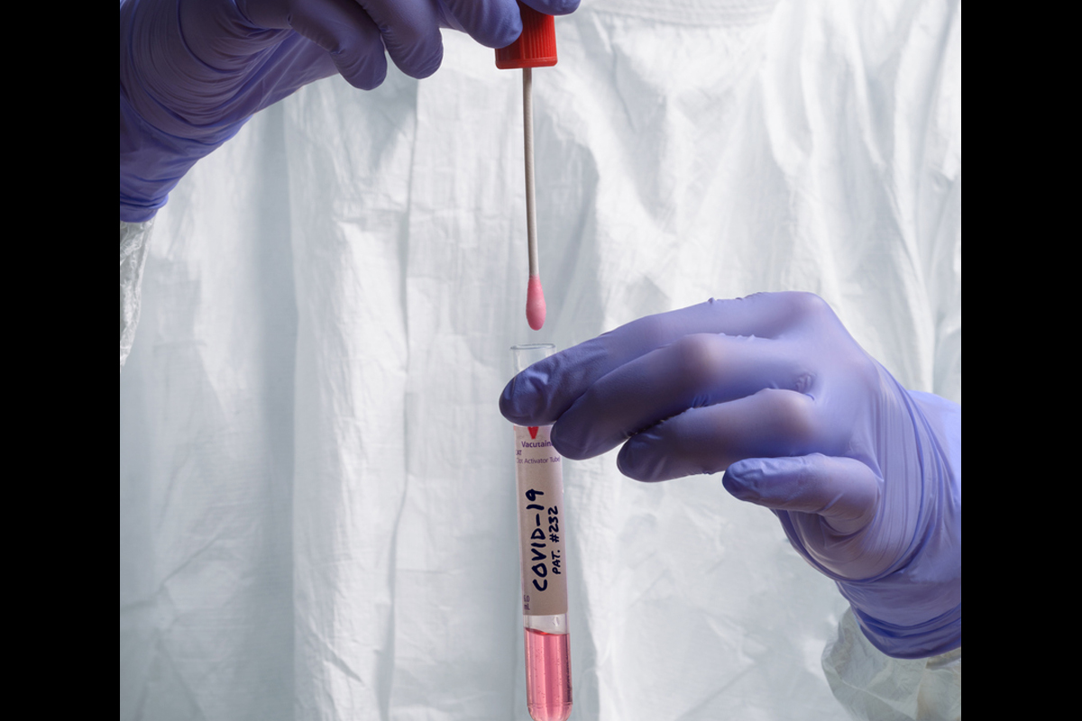 41 percent local contact cases in BBSR