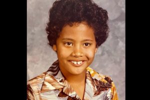 Dwayne Johnson reveals he had ‘buck teeth’ as a kid