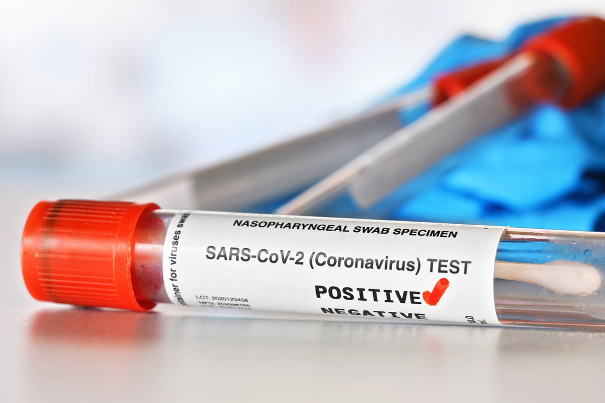 COVID-19 infections, Odisha, Coronavirus, recovery rate