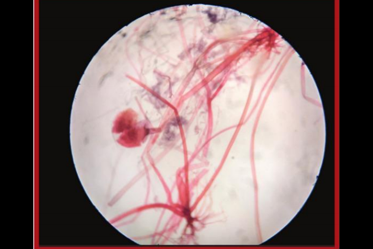 The Dreaded Fungus