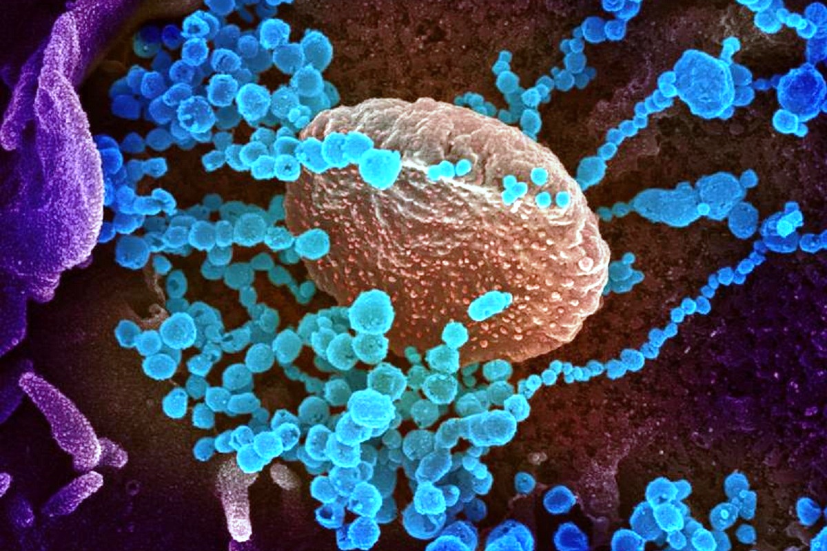 Covid virus may reach various layers of human retina: Study