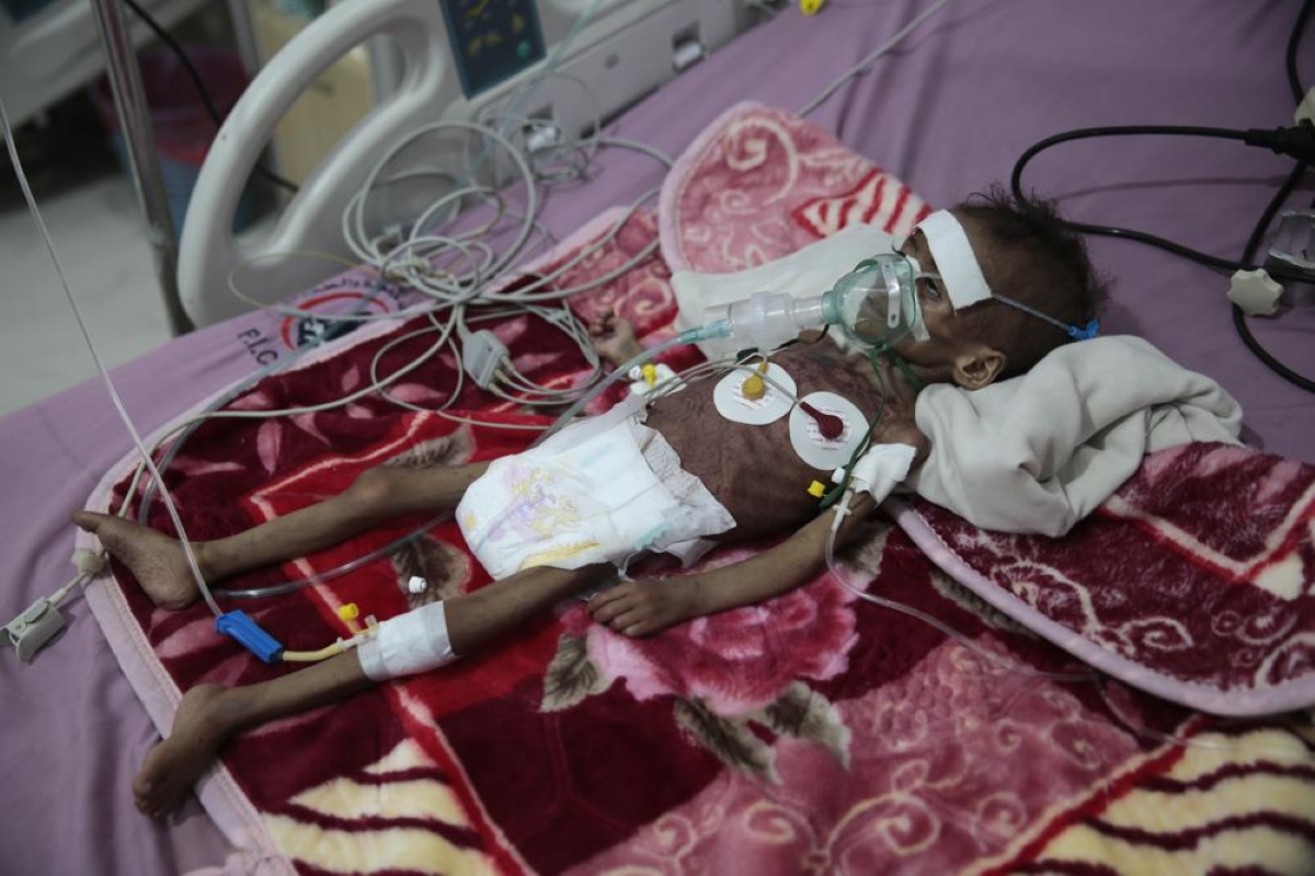 UN: In war, 16 million Yemenis ‘marching’ toward starvation