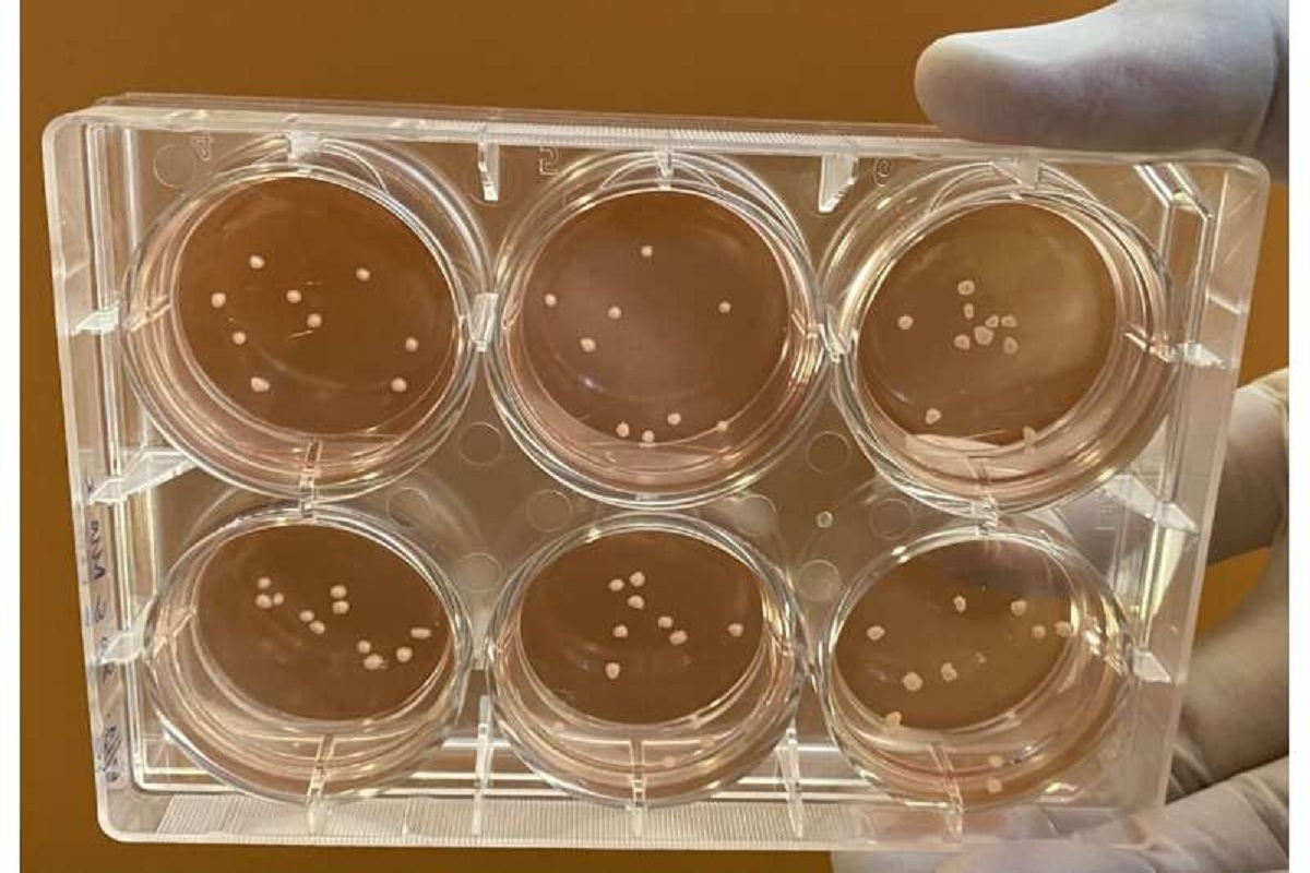 Mini-brains in lab mimic Parkinson’s disease