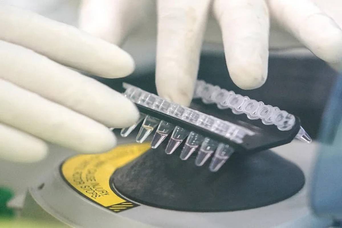 LifeCell gets DCGI nod for clinical trial of cell therapy to treat COVID patients