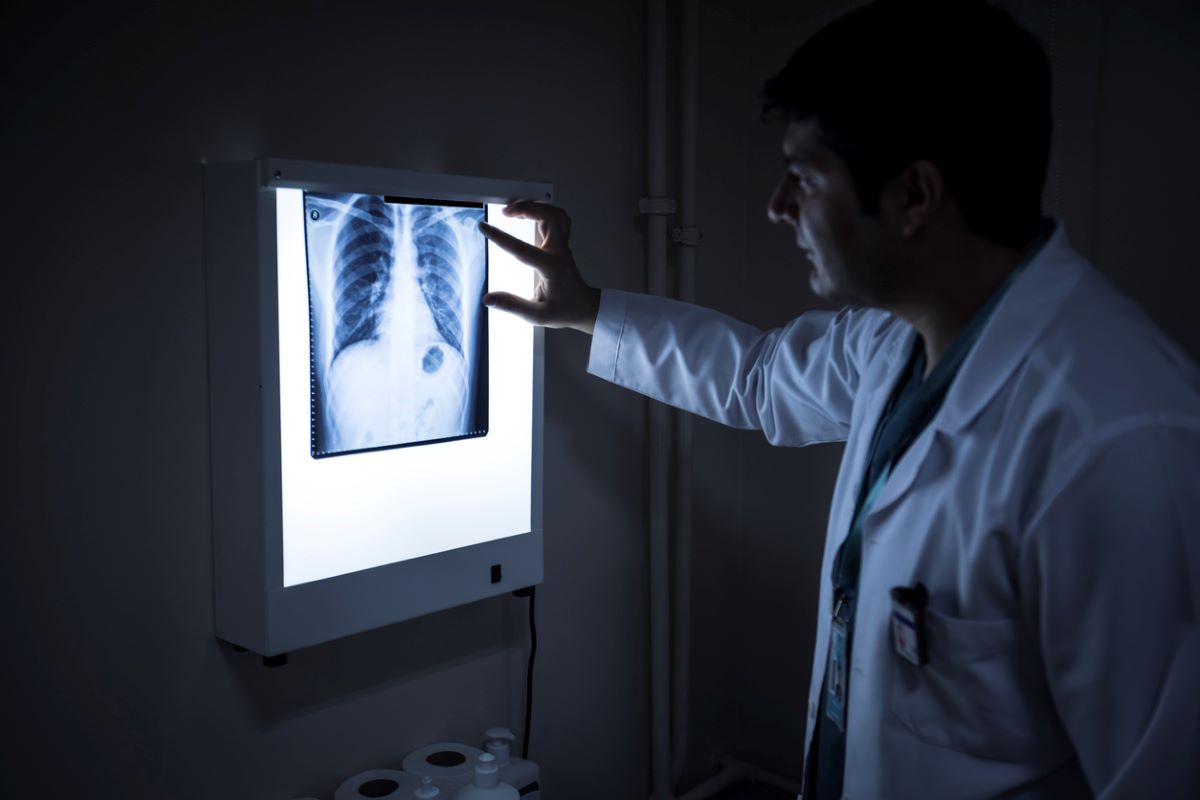 Innovative X-ray imaging shows COVID-19 can cause vascular damage to the heart: Study