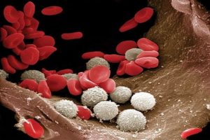 How white blood cells aid in predicting Covid-19 severity