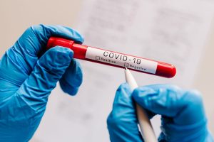 Centre worried at low Covid testing in states