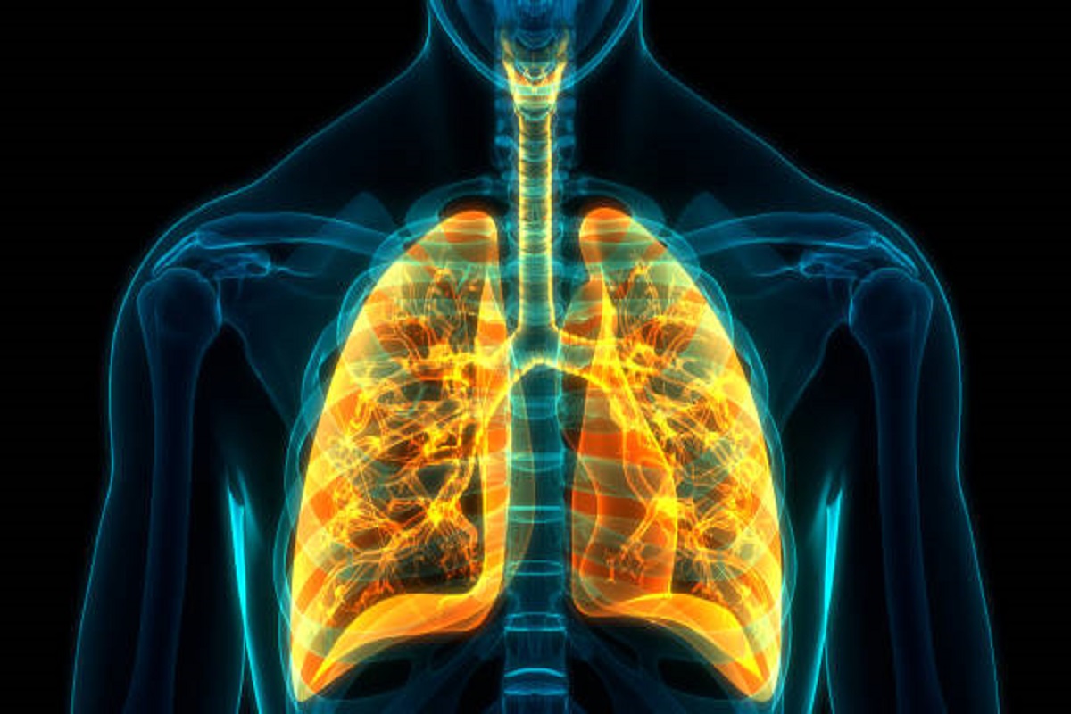 Chronic obstructive pulmonary disease, post-COVID, devastative disease