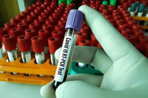 Rapid PCR, RT-PCR test rates slashed at Chennai airport