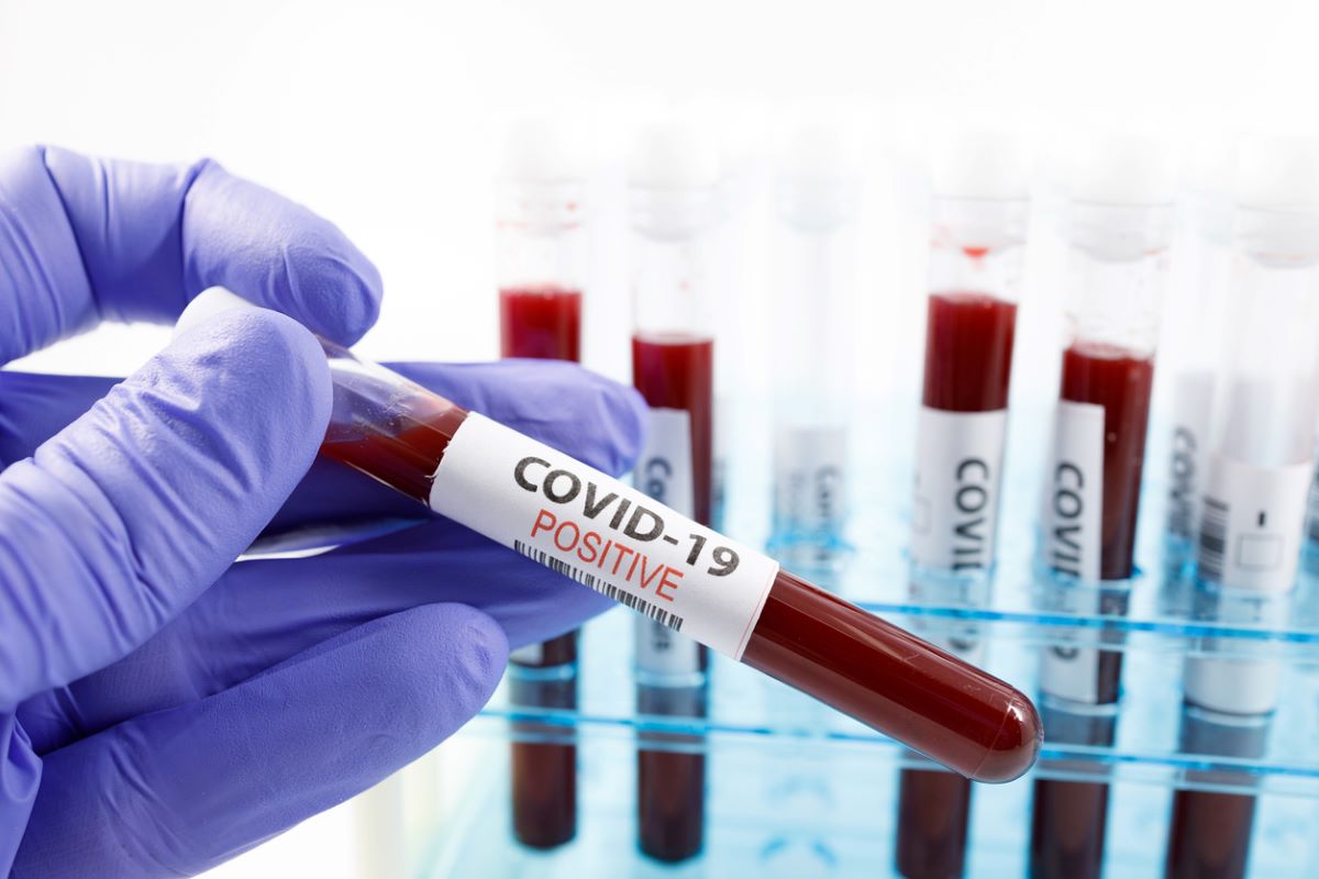 Odisha reports 1,497 new COVID-19 cases; 29% drop in infection